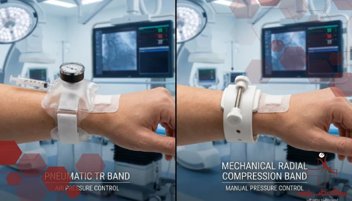 مقایسه تی آر بند بادی و رادیال بند مکانیکی برای کنترل خونریزی شریان رادیال پس از آنژیوگرافی