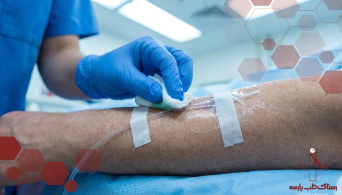 پرسنل پزشکی در حال تمیز کردن محل ورود کاتتر با گاز استریل و محلول ضدعفونی