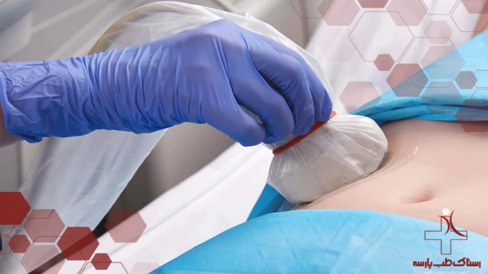 راهنمای خرید کاور پروب