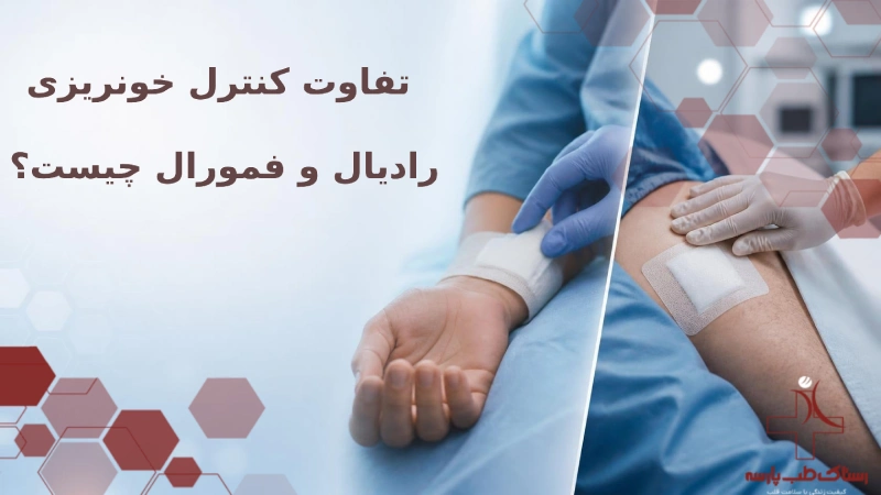 تفاوت خونریزی رادیال و فمورال